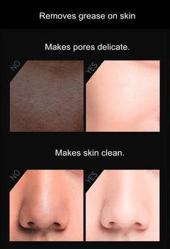 Volcanic Stone Oil-Absorbing Face Roller (Must Have)