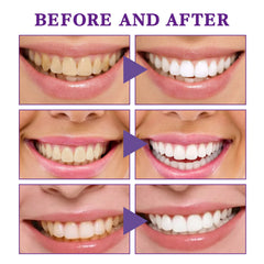 Teeth Whitening & Gum Care Mousse